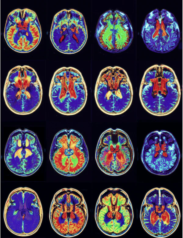 Colorful Brain Scans