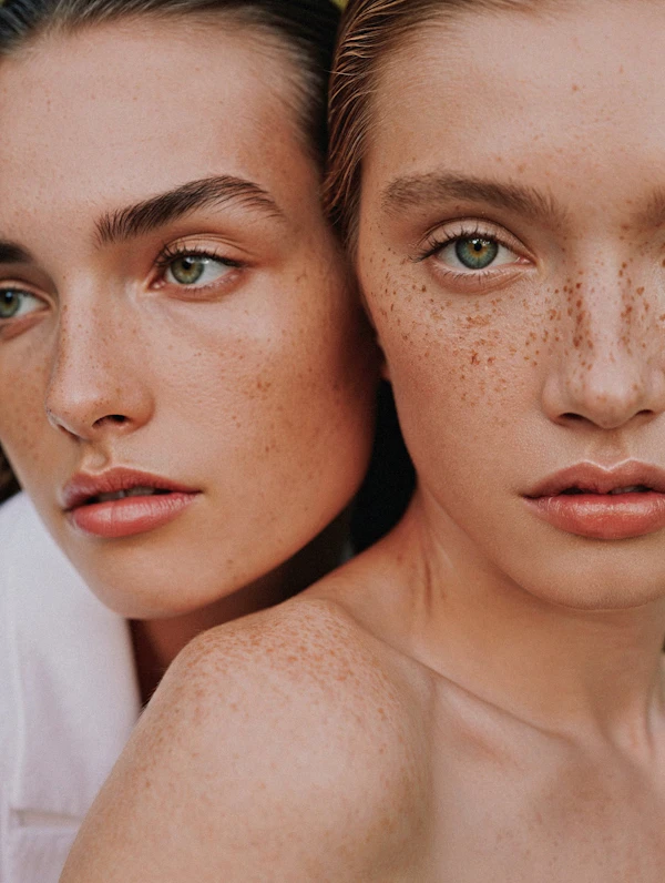Freckled Serenity