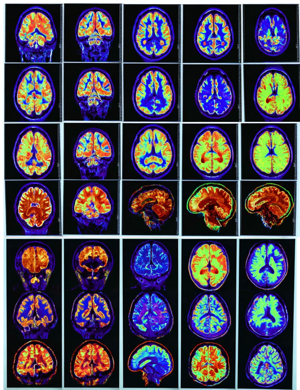 Colorful Brain Scans Photo on Lummi
