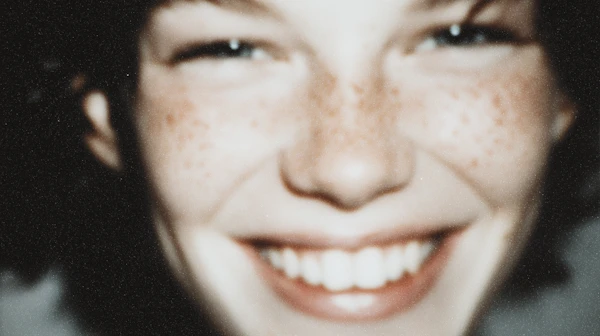 Smiling Freckled Face