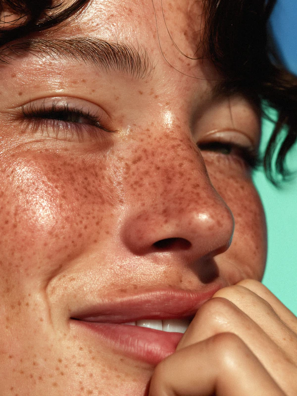 Freckled Face Close-Up